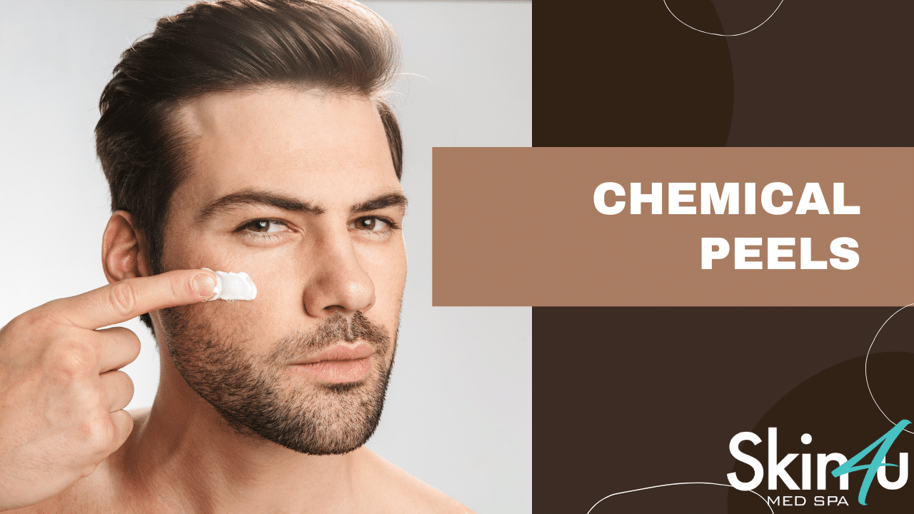 1743710957 chemical peel for Men